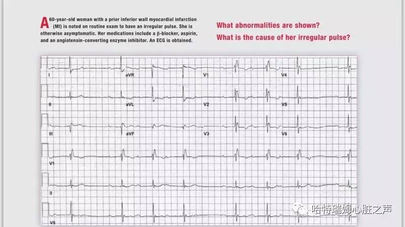 读心有术是什么意思,读心有术讲的是什么