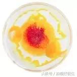 原位癌与转移癌的区别,病理如何判断原位癌和浸润性癌