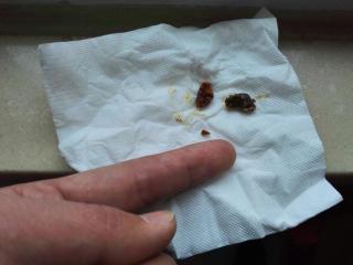 怎样才能挖到这么大块耳屎?恶心!但看着好爽啊!