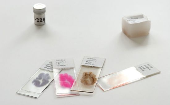 你有考虑过将来捐献器官救人吗,陈天桥为什么执着脑科学研究