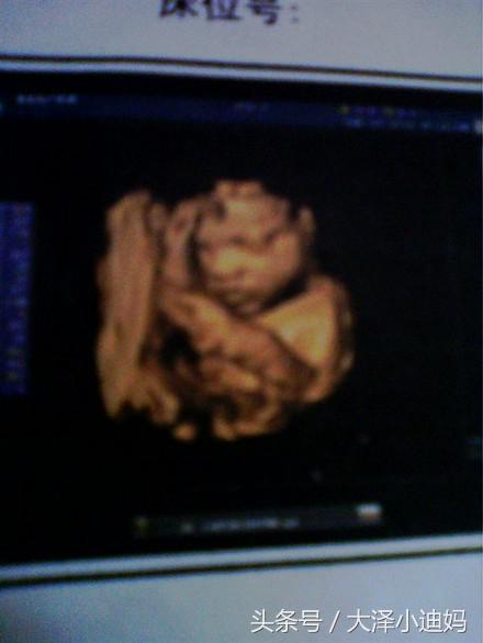 人流后第三个月就查出怀孕了,人流后一个月怀孕了能药流吗