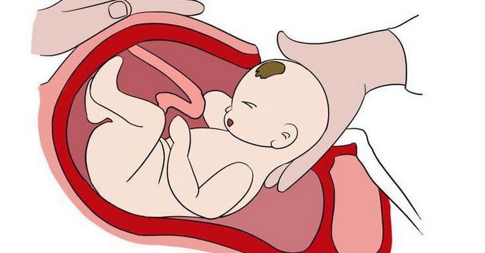 产妇比较胖是顺产好还是剖腹产好,剖腹产和顺产哪个对身体影响最大