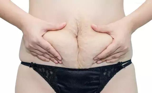 产后肚皮松垮怎么变紧致,产后肚子松松垮垮怎么运动