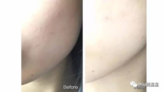 提拉紧致美容仪评测 (紧致提拉美容仪到底有没有用)