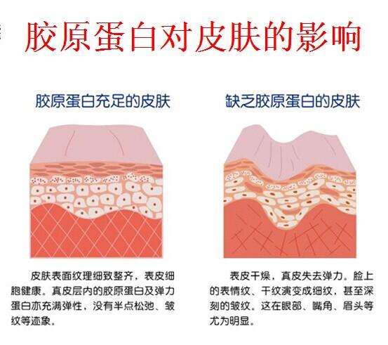 超声刀是什么美容项目,超声刀是什么科室用的