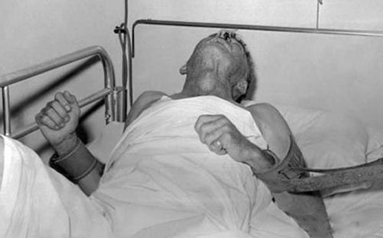 狂犬病要被发作的动物咬到才有吗,动物没有狂犬病咬人会得狂犬病吗