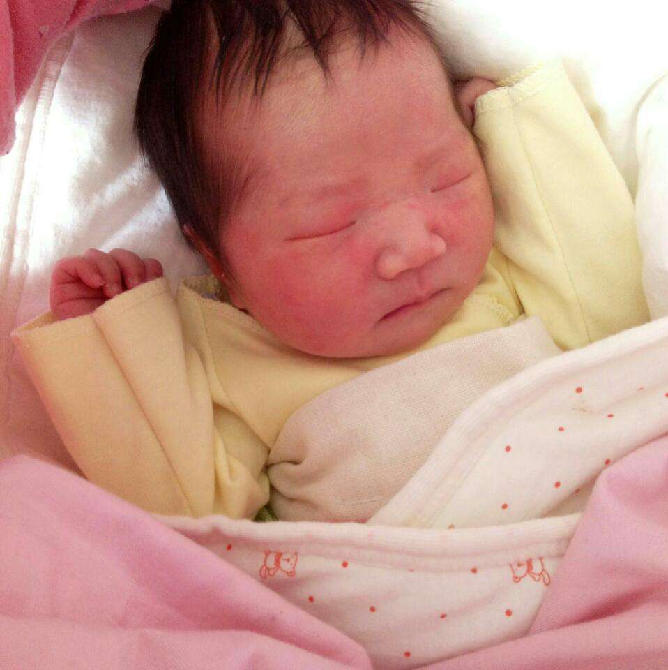 宝宝患上鹅口疮怎么办,宝宝得了鹅口疮的表现是什么