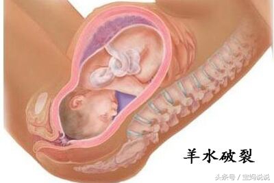 孕妈妈产检宝宝在尿床,孕妇怀孕28周睡觉尿床是怎么回事