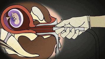 天价人流你听说过吗？——答一位中学生的来信