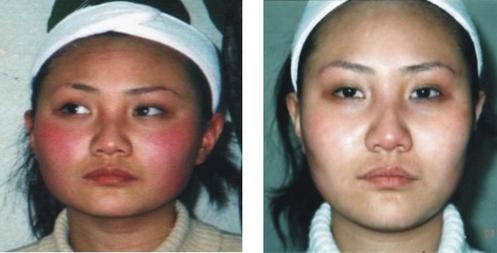 这也是皮肤一大杀手，很多人都不知道！