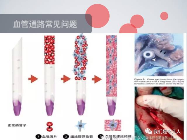血透净化标准操作规程,血液净化基本操作技术