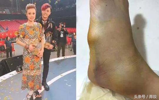 杨幂的脚很臭,而这些女明星的脚“惨不忍睹”