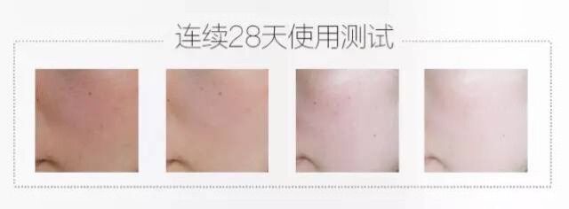 女人长斑肤质差教你一招轻松淡斑,刘艳青美白淡斑