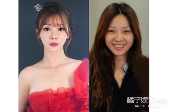 笑容引起的法令纹怎么解决,怎么样的笑容可以改善法令纹