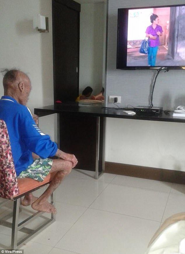 全身被烧伤后的皮肤,皮肤烧伤起皮疹