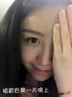 眉毛稀少是否也能种植,眉毛短可以种植眉毛吗