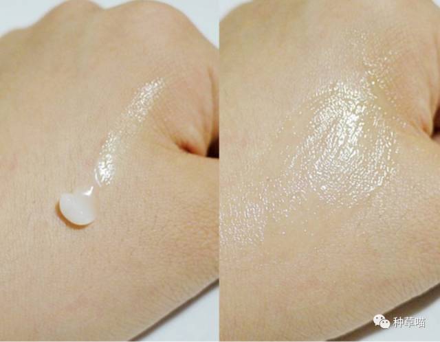 祛痘去痘大作战,公认最好用的祛痘神器