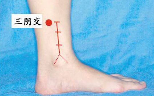 人流后小腹疼怎么办快速缓解,女人人流过后肚子疼