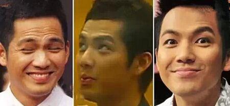 6个小窍门巧妙去除抬头纹,从小就有抬头纹怎么消除简单方法