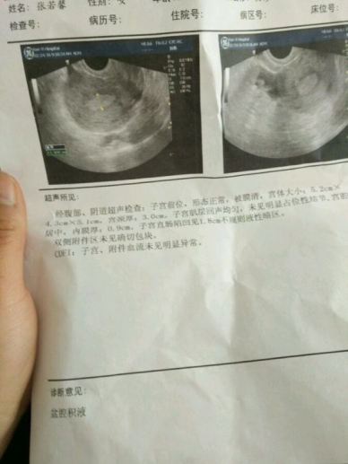 月经推迟是大病的前兆吗,月经推迟有可能是什么病