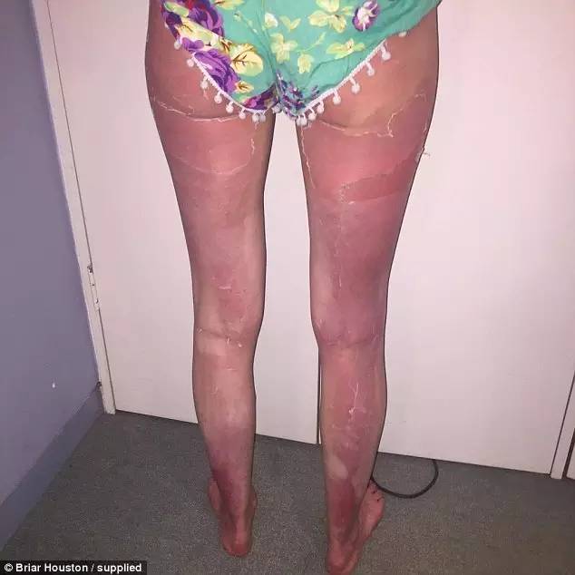 最近什么品牌防晒出问题了 (防晒霜出问题2018年)