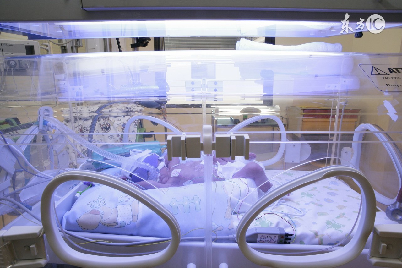 新生儿黄疸能吃能睡要紧吗,新生儿3天黄疸16要紧吗