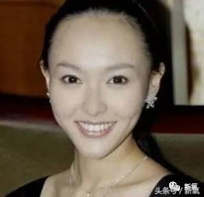 杨幂发际线还会回归吗,杨幂发际线秃到后脑勺