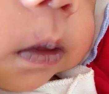 嘴唇变青、变紫、变黑,是身体出了大问题?从唇色读懂身体的秘密!