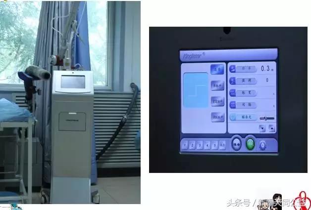 除了HIV,你还要知道尖锐湿疣防治核心信息