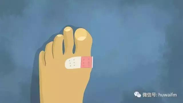 脚上长了水泡怎样才会好得快,一只脚上长水泡是什么原因引起的