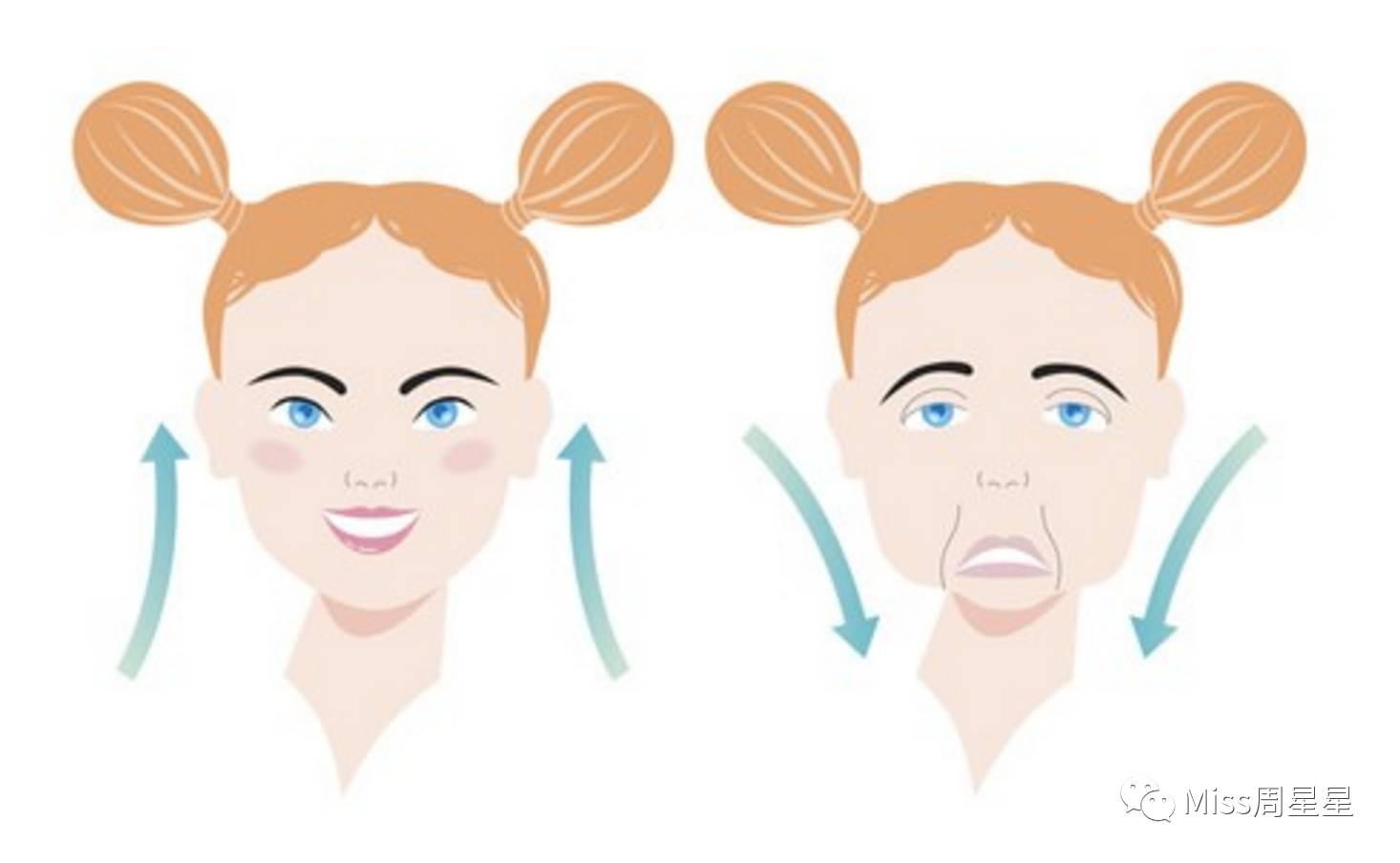 脸部凹陷法令纹用什么美容仪,stop射频美容仪祛法令纹