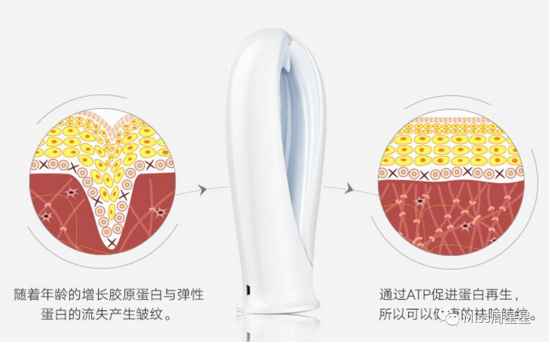 iluminage激光美容仪用法,面部提升紧致美容仪iluminage