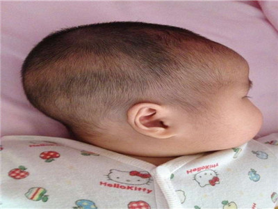 刚出生的宝宝长什么样?这里五大现象,看得心发慌