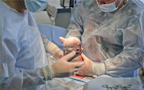 你生宝宝到底有多痛,生孩子时候你经历了哪些痛苦