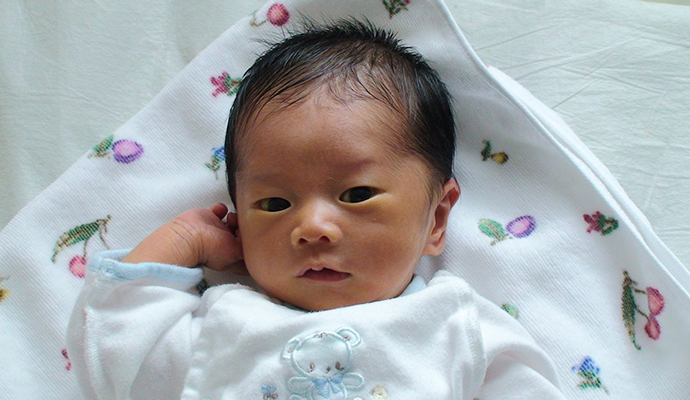 产前备用：快速识别新生儿黄疸症状及解决办法