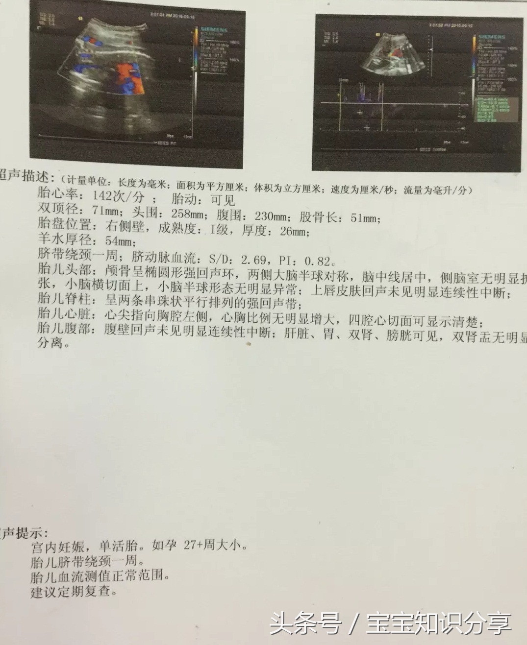 “男翻女”顺产助产士说“我可没儿子给你”把我逗笑了！这些都不准