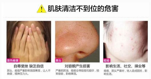 下巴反复长痘痘的原因和解决方法,下巴长期长痘痘的原因和解决方法