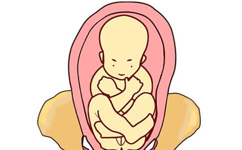 37周胎位不正脐带绕颈1周怎么矫正,胎位不正怎么纠正最快注意事项