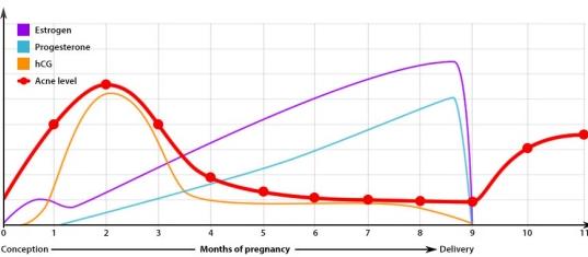 为啥生理期冒痘,经常长痘的原因和解决方法