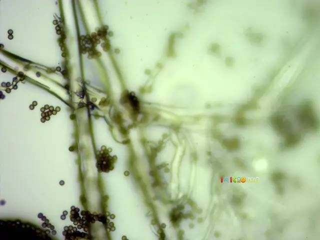 显微镜奇妙世界,显微镜下的奇妙世界视频