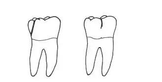 omg卡住了怎么回事,omg治疗