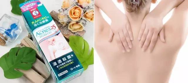 祛除背部痘痘神器,消除痘痘的好产品