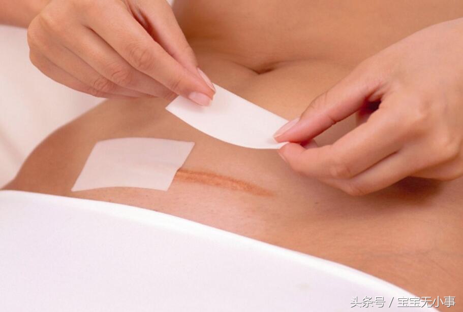 所有剖腹产妈妈逃不掉的4种痛，总有一种让你刻骨铭心