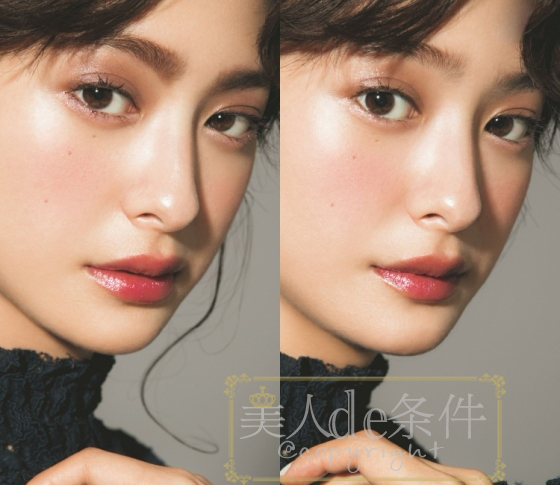 眉头太低打玻尿酸怎么能提上去,经常皱眉要不要打玻尿酸