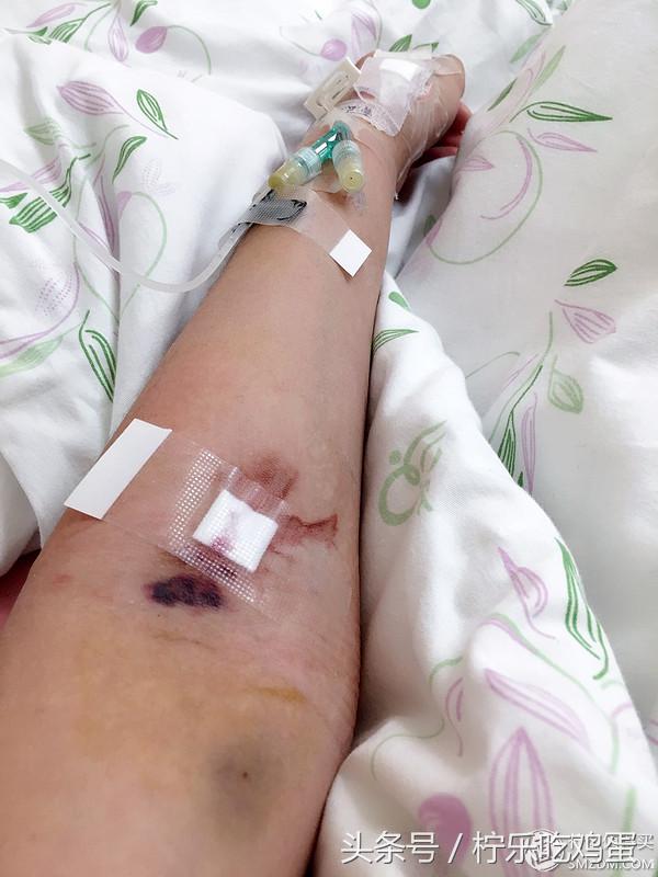 早产宝宝有自带母体抵抗力,早产宝宝也可以很棒