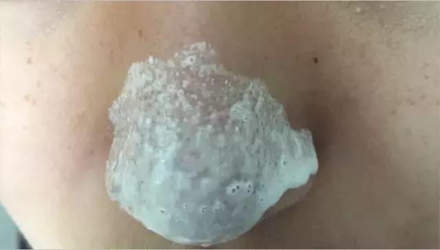 猪鼻贴去黑头,泰国进口去黑头鼻贴