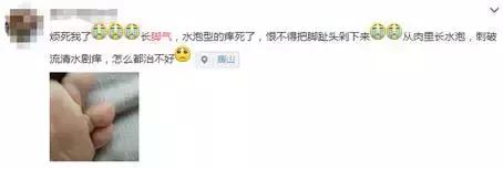 快！闻闻你的脚！听说大部分武汉伢都有脚气