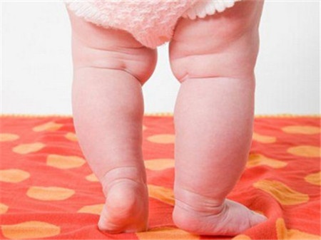 新生儿小腿弯怎么回事,新生儿小腿很弯是什么原因
