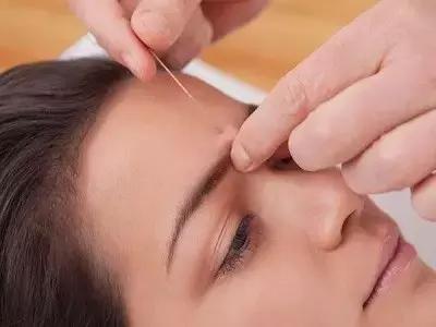 杨幂治掉头发防脱发,杨幂放血治感冒吗