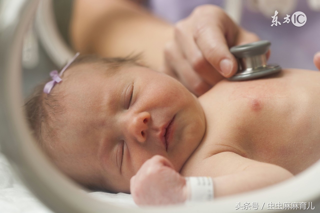 了解新生儿黄疸常见的原因,谈谈新生儿黄疸的护理知识